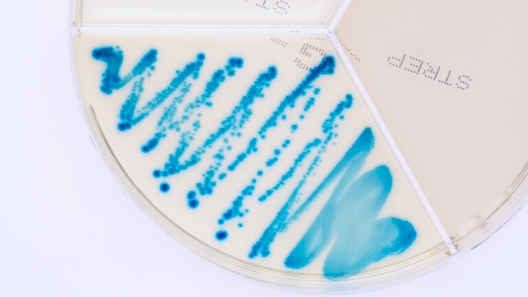Klebsiella oxytoca ClearMilk Test