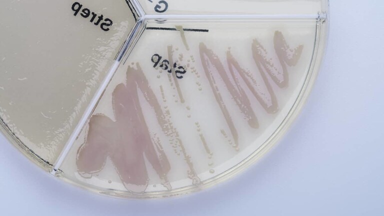 Staphylococcus chromogenes ClearMilk Test