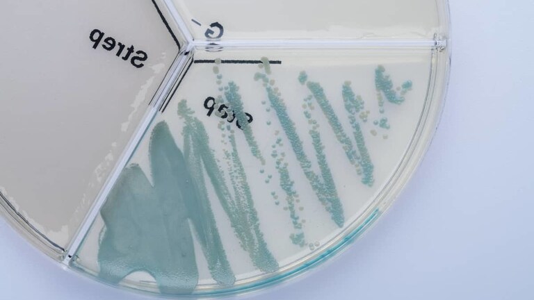 Staphylococcus xylosus ClearMilk Test